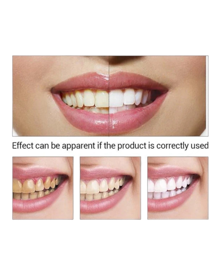 Teeth Whitening Drops